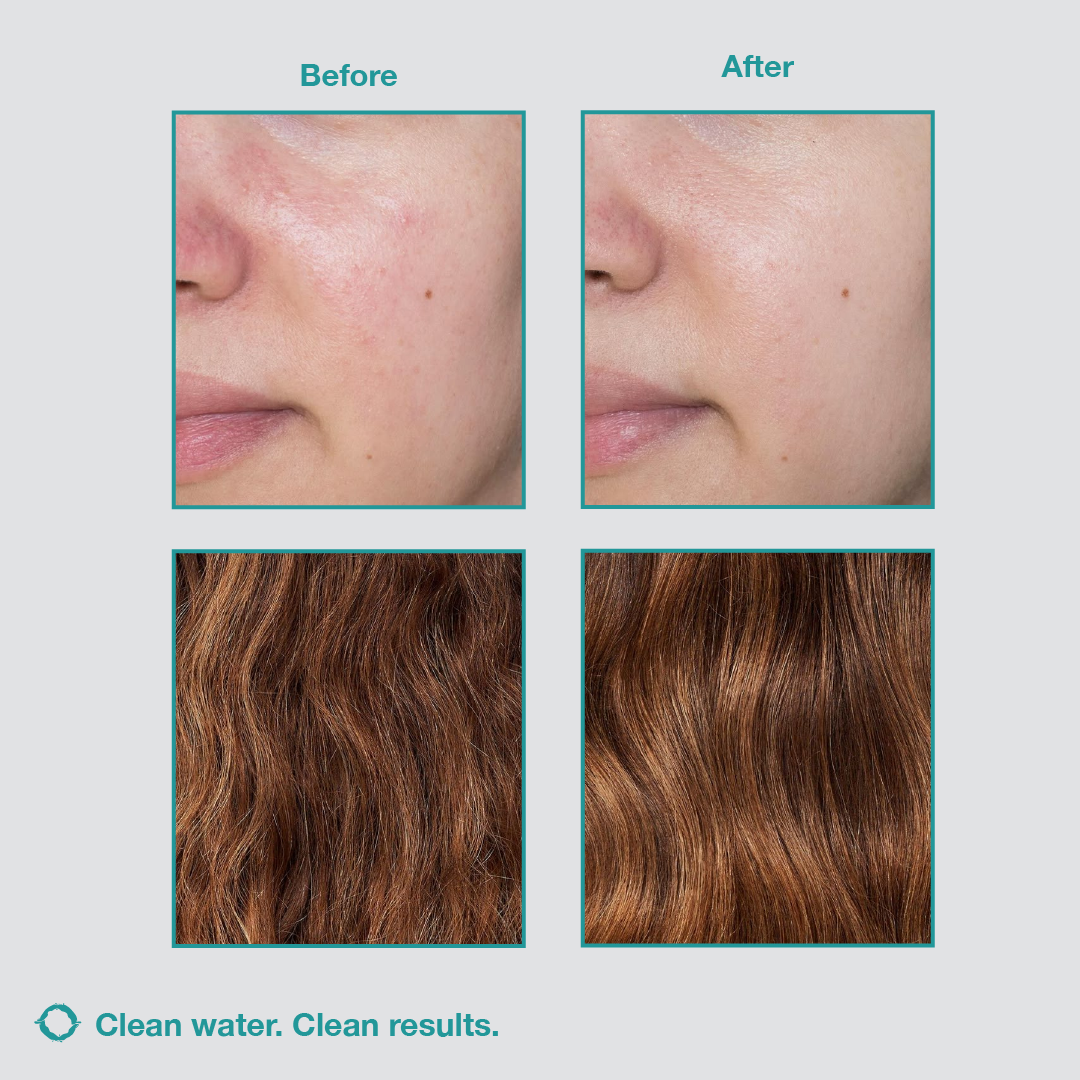 Bluorya™ Filtered High-Pressure Shower Head