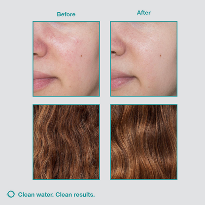 Bluorya™ Filtered High-Pressure Shower Head